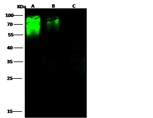 Hepatitis C Virus E2 Antibody in Western Blot (WB)
