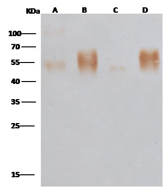 Ebola Virus GP-RBD (subtype Zaire, strain Mayinga 1976) Antibody in Western Blot (WB)
