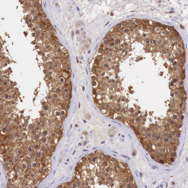 GAB2 Antibody in Immunohistochemistry (Paraffin) (IHC (P))