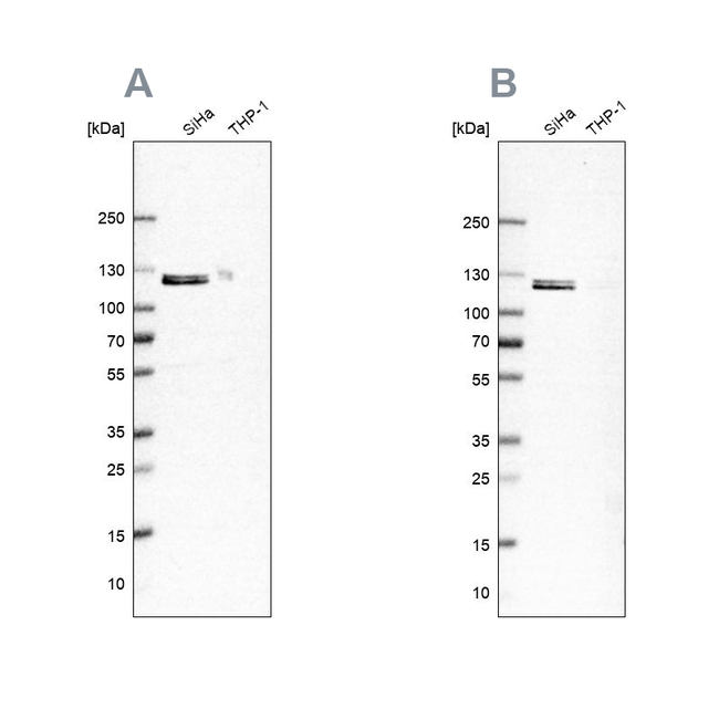 UBE1 Antibody in Western Blot (WB)