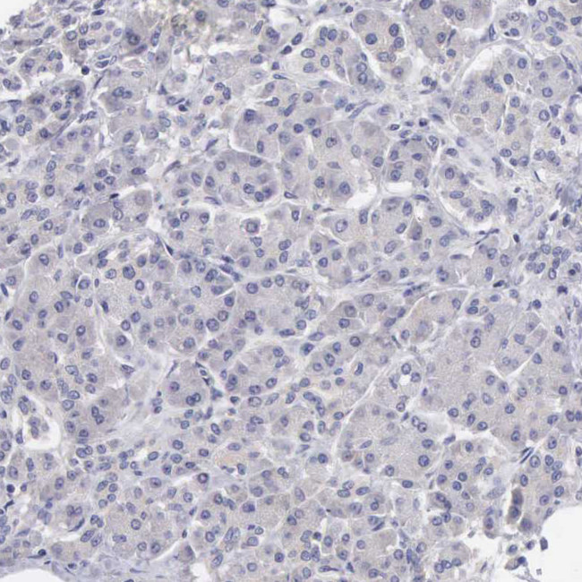 SLITRK4 Antibody in Immunohistochemistry (Paraffin) (IHC (P))