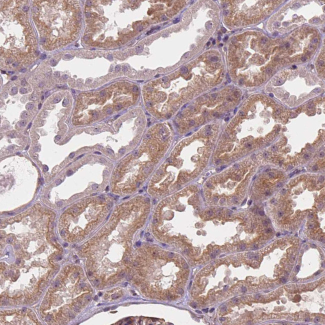 AMMECR1 Antibody in Immunohistochemistry (Paraffin) (IHC (P))