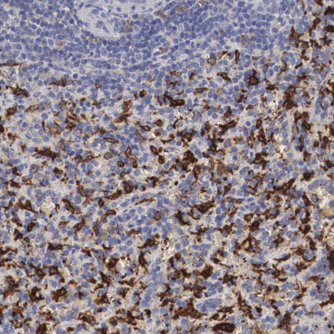 HMOX1 Antibody in Immunohistochemistry (Paraffin) (IHC (P))