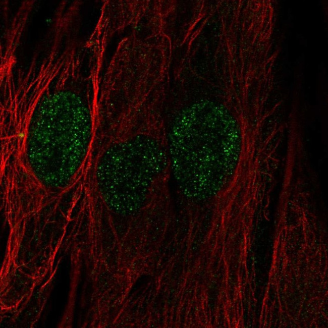 C22orf23 Antibody in Immunocytochemistry (ICC/IF)