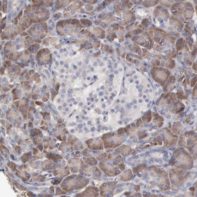 MTHFD1 Antibody in Immunohistochemistry (Paraffin) (IHC (P))
