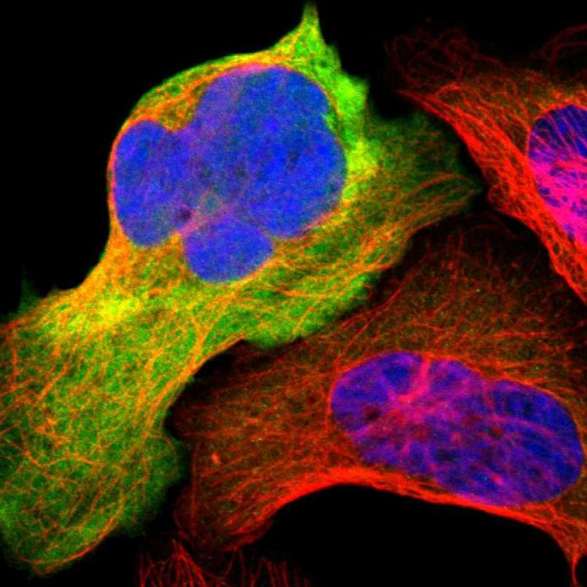 ENO3 Antibody in Immunocytochemistry (ICC/IF)