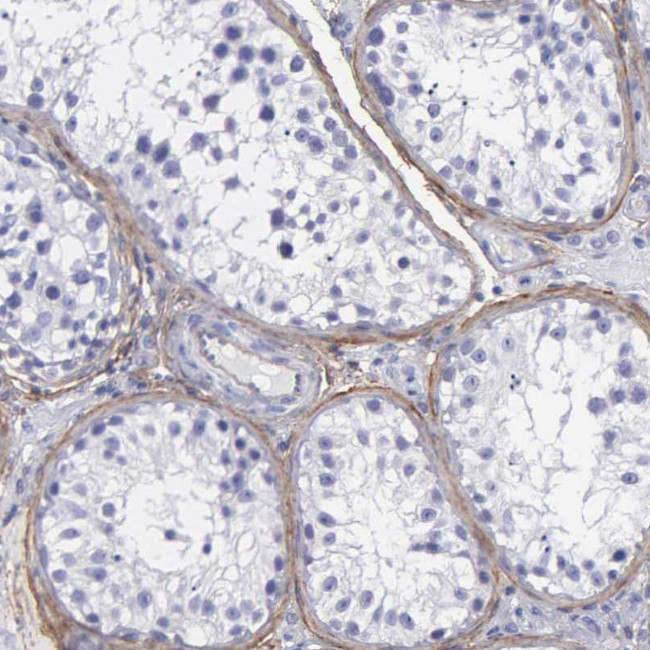 Fibulin 5 Antibody in Immunohistochemistry (Paraffin) (IHC (P))