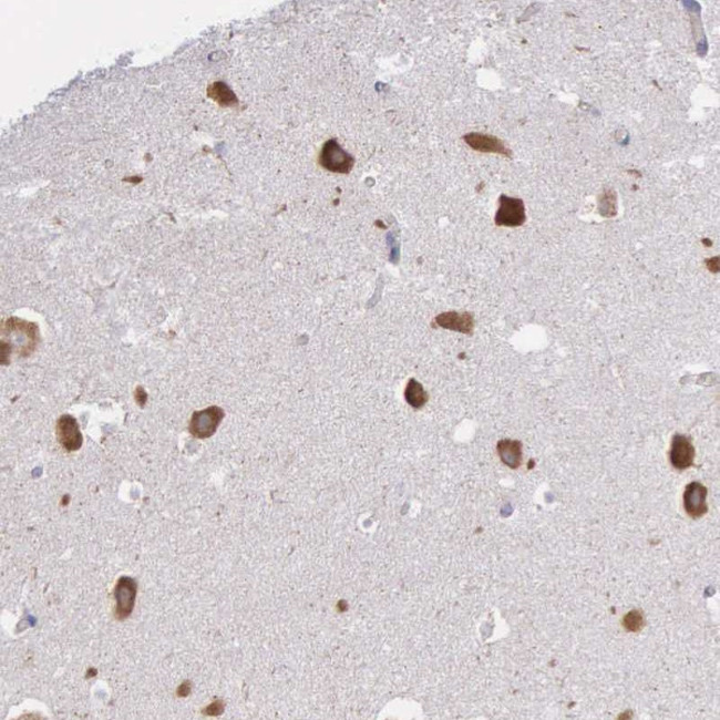 CTAGE5 Antibody in Immunohistochemistry (Paraffin) (IHC (P))