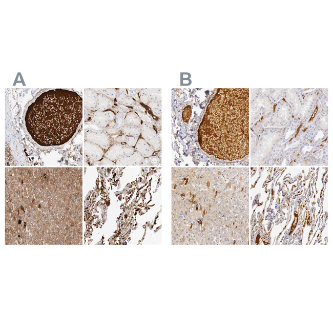 C4BPA Antibody in Immunohistochemistry (Paraffin) (IHC (P))