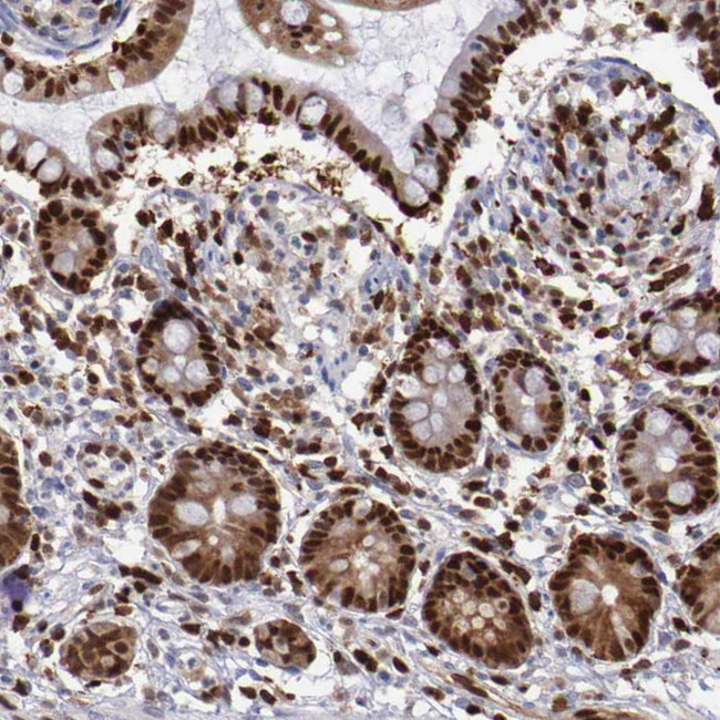 PDCD4 Antibody in Immunohistochemistry (Paraffin) (IHC (P))