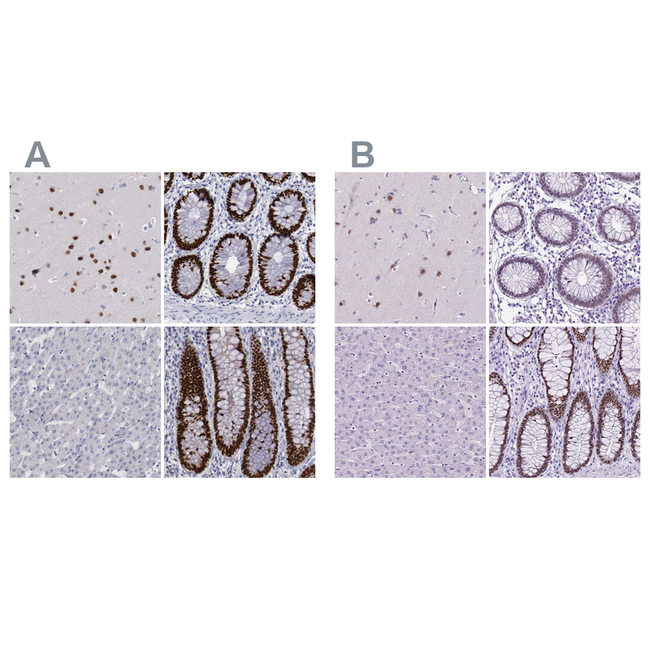 SATB2 Antibody in Immunohistochemistry (Paraffin) (IHC (P))