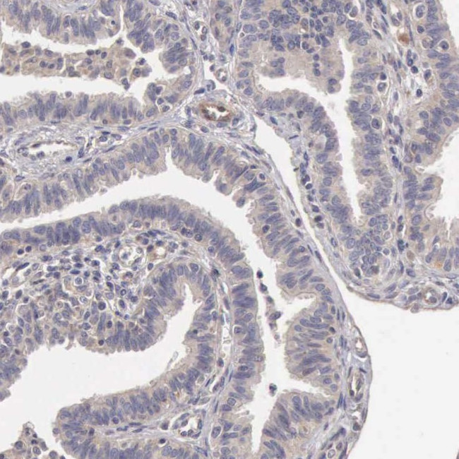 ETK Antibody in Immunohistochemistry (Paraffin) (IHC (P))