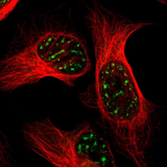 BRD1 Antibody in Immunocytochemistry (ICC/IF)