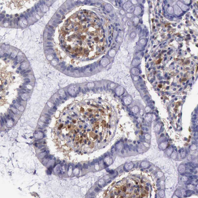 Thymidine Phosphorylase Antibody in Immunohistochemistry (Paraffin) (IHC (P))