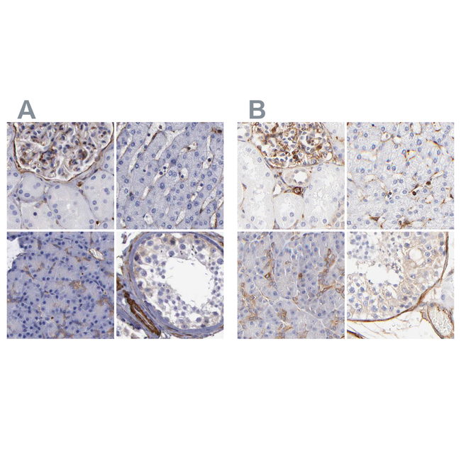 Filamin A Antibody in Immunohistochemistry (Paraffin) (IHC (P))