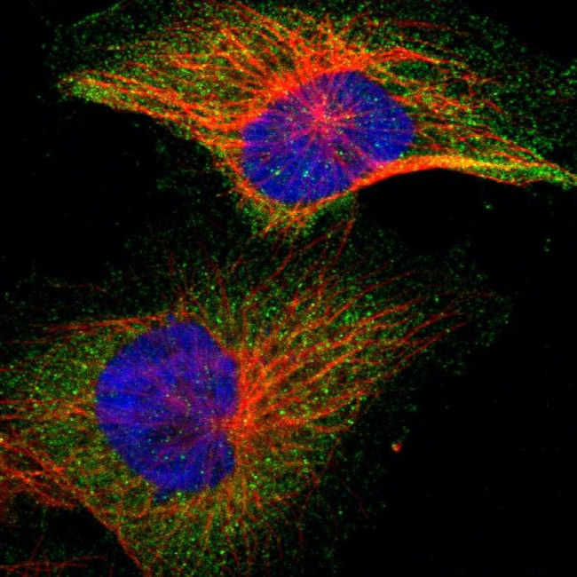IKK beta Antibody in Immunocytochemistry (ICC/IF)