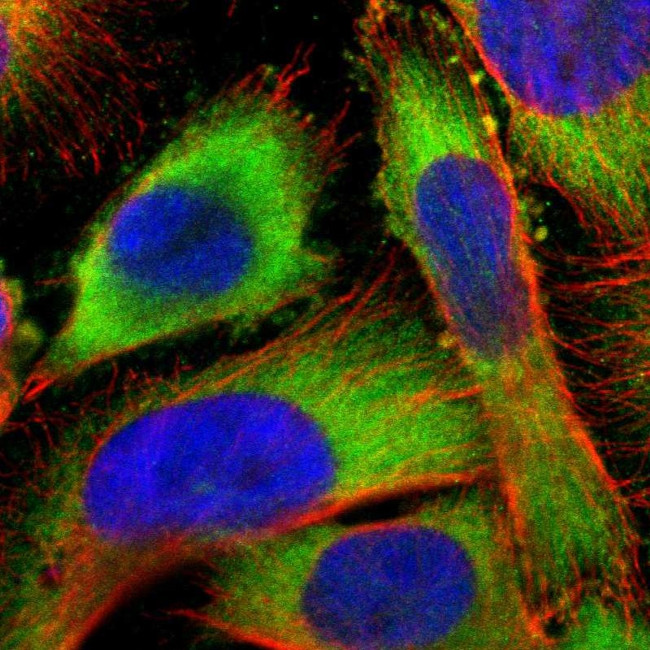 USP14 Antibody in Immunocytochemistry (ICC/IF)