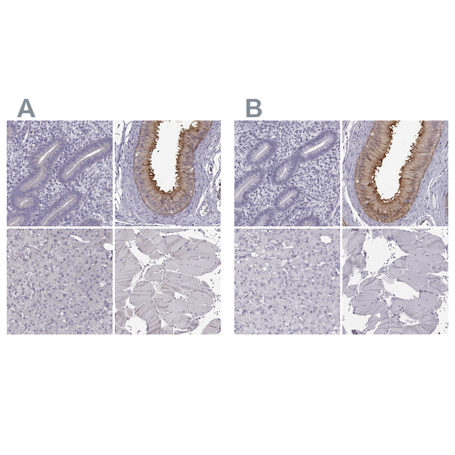 GPR64 Antibody in Immunohistochemistry (Paraffin) (IHC (P))
