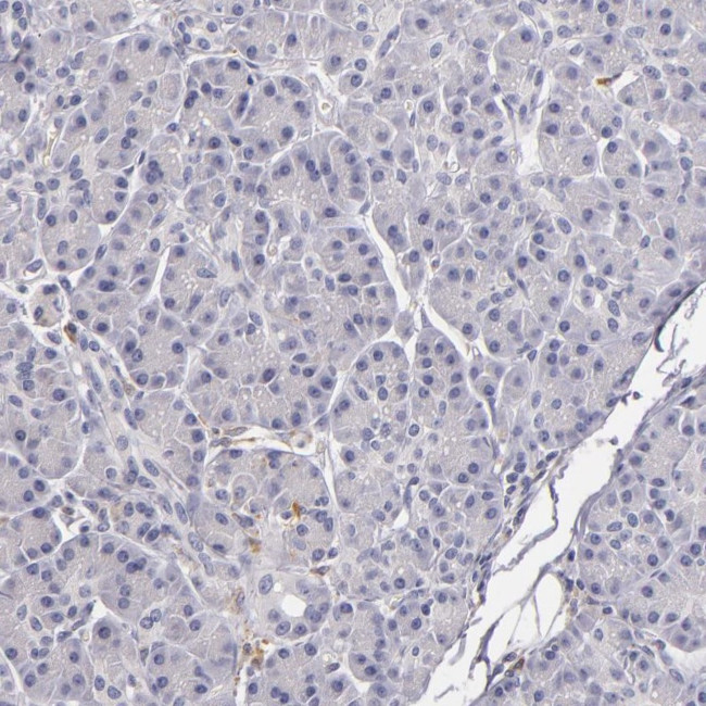 TLR8 Antibody in Immunohistochemistry (Paraffin) (IHC (P))