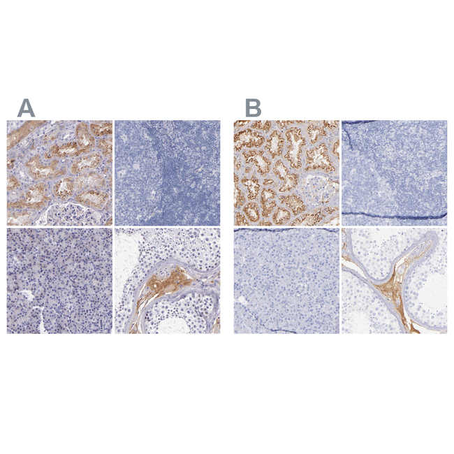 Kininogen 1 Antibody in Immunohistochemistry (Paraffin) (IHC (P))