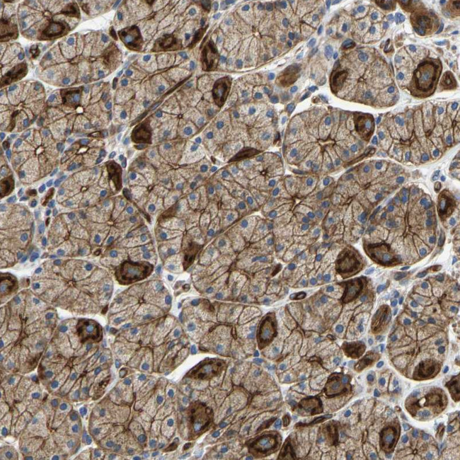 MYO1C Antibody in Immunohistochemistry (Paraffin) (IHC (P))