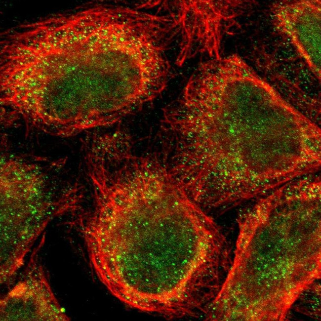 AF9 Antibody in Immunocytochemistry (ICC/IF)
