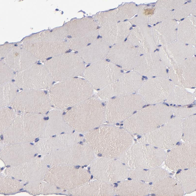 SHC Antibody in Immunohistochemistry (Paraffin) (IHC (P))