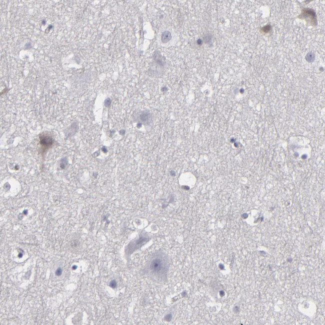 LRG1 Antibody in Immunohistochemistry (Paraffin) (IHC (P))