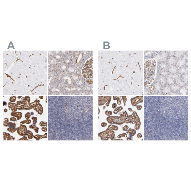 Laminin gamma-1 Antibody in Immunohistochemistry (Paraffin) (IHC (P))