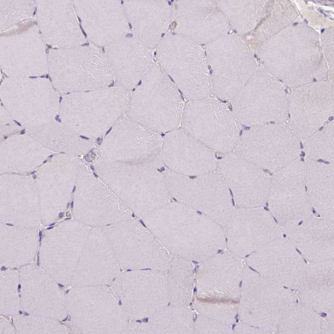 MA2 Antibody in Immunohistochemistry (Paraffin) (IHC (P))