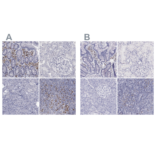 IRF4 Antibody in Immunohistochemistry (Paraffin) (IHC (P))