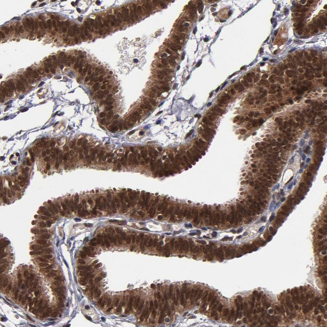 Cullin 5 Antibody in Immunohistochemistry (Paraffin) (IHC (P))
