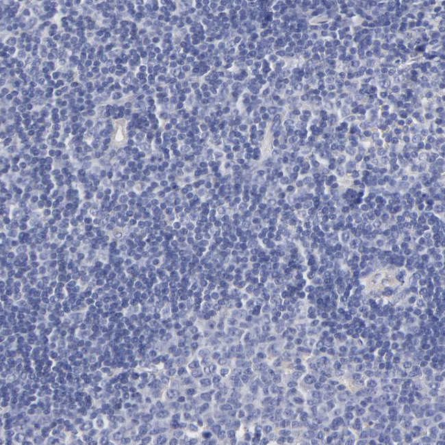 HS3ST1 Antibody in Immunohistochemistry (Paraffin) (IHC (P))