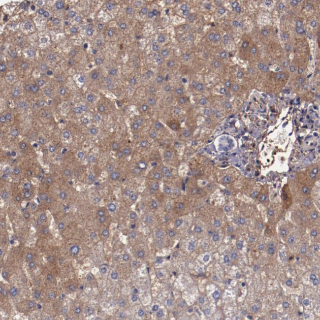 A2M Antibody in Immunohistochemistry (Paraffin) (IHC (P))