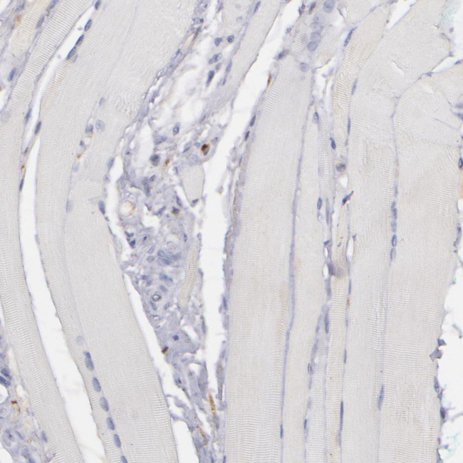 C1QA Antibody in Immunohistochemistry (Paraffin) (IHC (P))