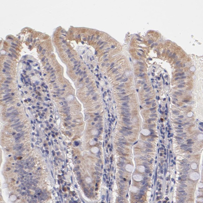 RNaseL Antibody in Immunohistochemistry (Paraffin) (IHC (P))