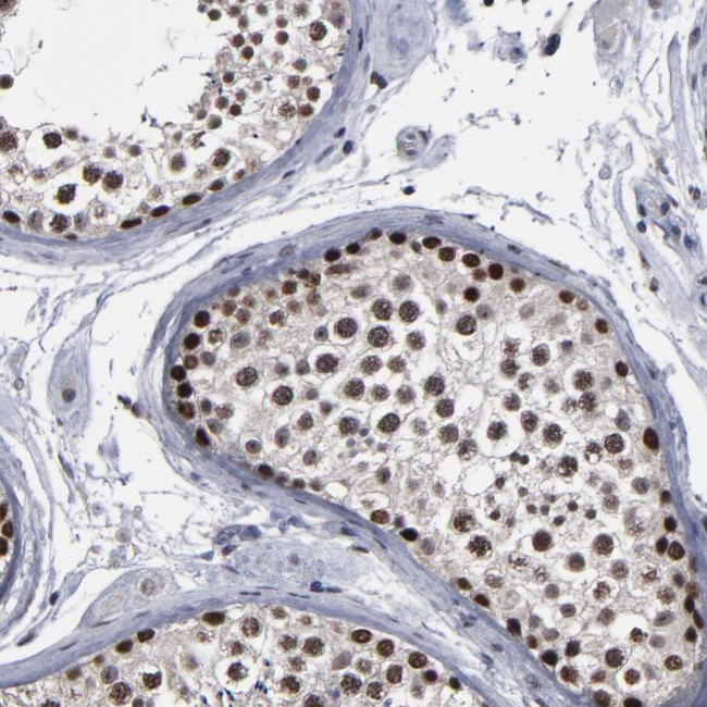 SSRP1 Antibody in Immunohistochemistry (Paraffin) (IHC (P))