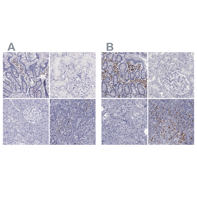 IRF4 Antibody in Immunohistochemistry (Paraffin) (IHC (P))