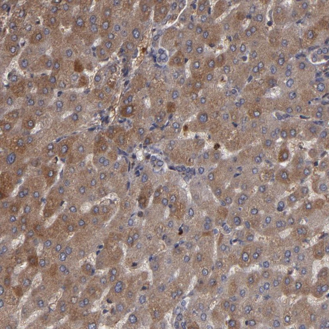 SERPINA7 Antibody in Immunohistochemistry (Paraffin) (IHC (P))
