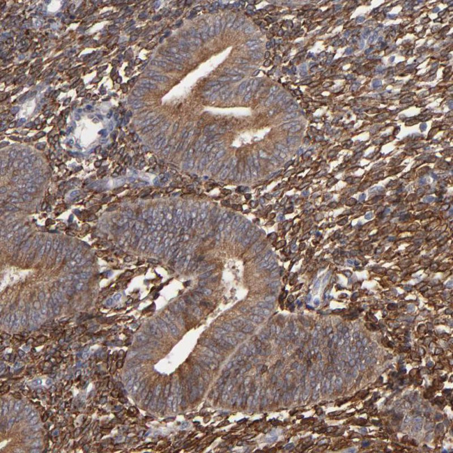 PGRMC1 Antibody in Immunohistochemistry (Paraffin) (IHC (P))