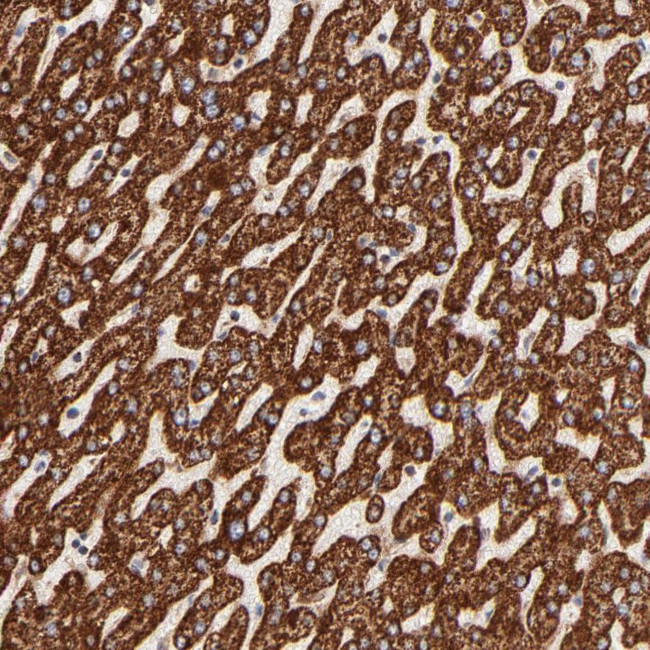 ECH1 Antibody in Immunohistochemistry (Paraffin) (IHC (P))