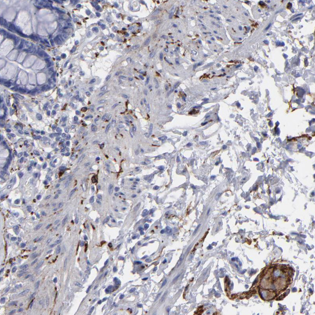 CADM3 Antibody in Immunohistochemistry (Paraffin) (IHC (P))