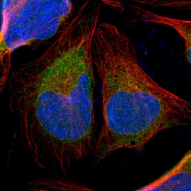 TMX Antibody in Immunocytochemistry (ICC/IF)