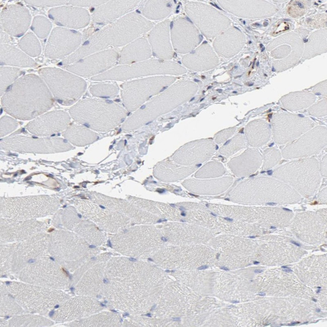 RAB9 Antibody in Immunohistochemistry (Paraffin) (IHC (P))