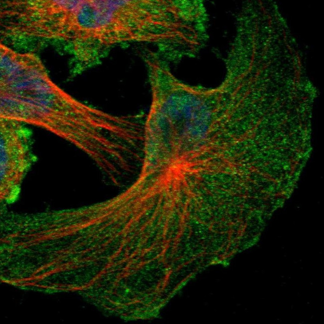 NF2 Antibody in Immunocytochemistry (ICC/IF)