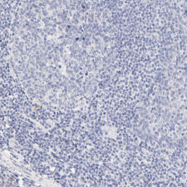 SULT4A1 Antibody in Immunohistochemistry (Paraffin) (IHC (P))