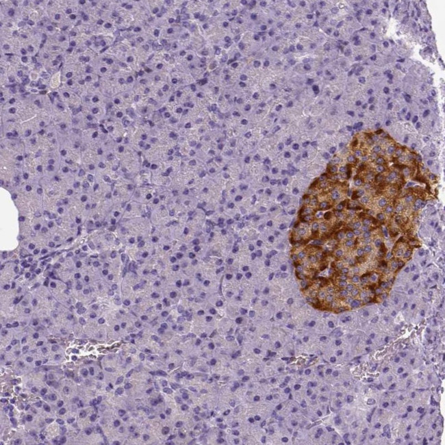 TSPAN7 Antibody in Immunohistochemistry (Paraffin) (IHC (P))