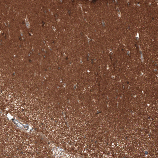 ATP6IP2 Antibody in Immunohistochemistry (Paraffin) (IHC (P))