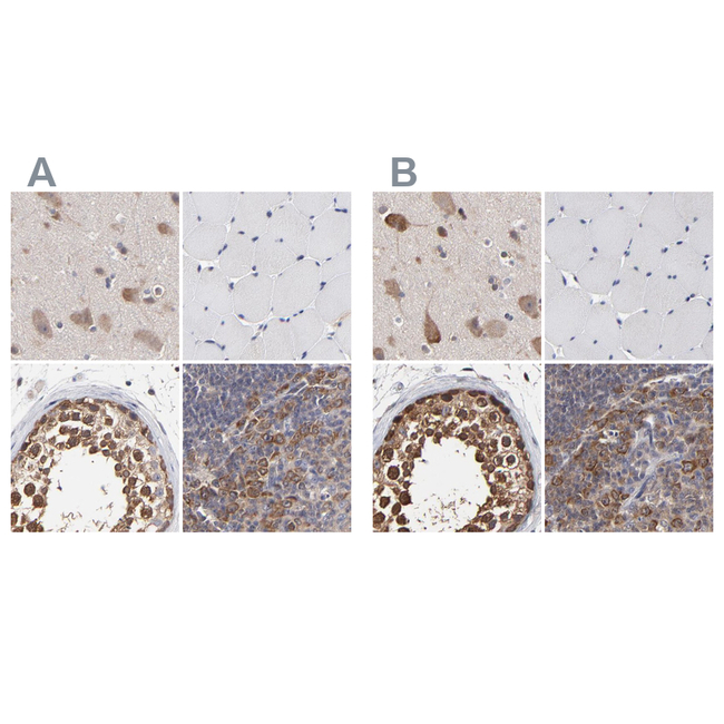 TCP-1 beta Antibody in Immunohistochemistry (Paraffin) (IHC (P))