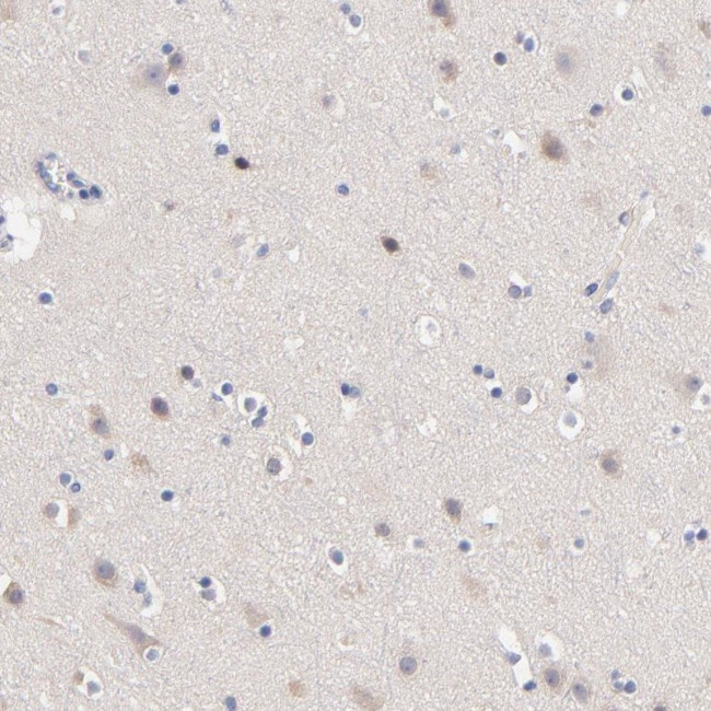 CD268 (BAFF Receptor) Antibody in Immunohistochemistry (Paraffin) (IHC (P))